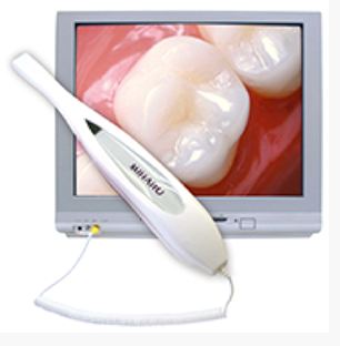 Intraoral camera from San Francisco Dental Arts in San Francisco, CA